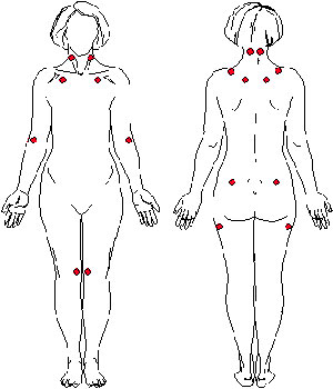 fibromyalgia jpg