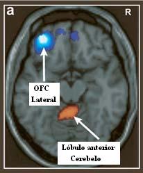 cerebro