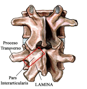 pars_interarticularis