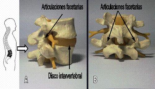 articulacion_facetaria