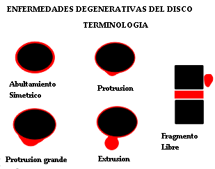 degeneracion_disco