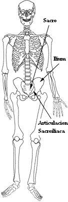 sacroilitis