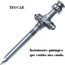 trocar