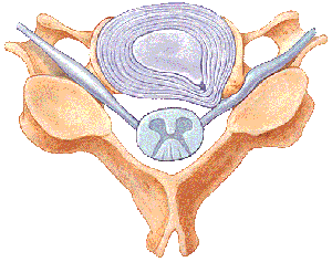 radiculopatia_cervical