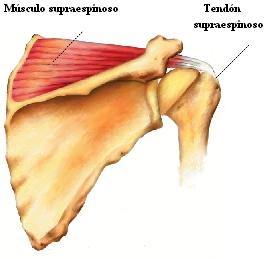 Músculo y tendón supraespinoso