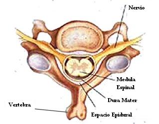 epidural_peridural