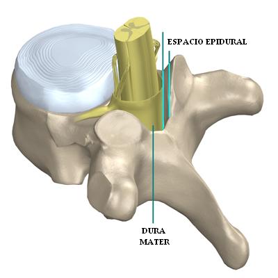 espacio_epidural