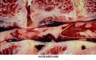 osteofitosis